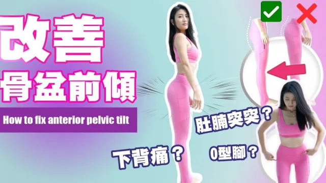 矯正骨盤前傾運動